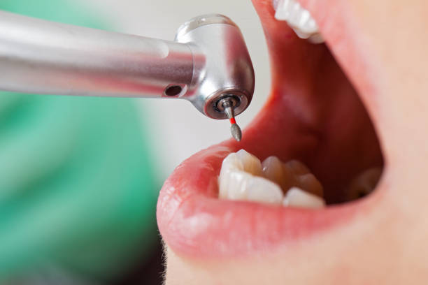 Best Pediatric Emergency Dentist in Bethel, WA